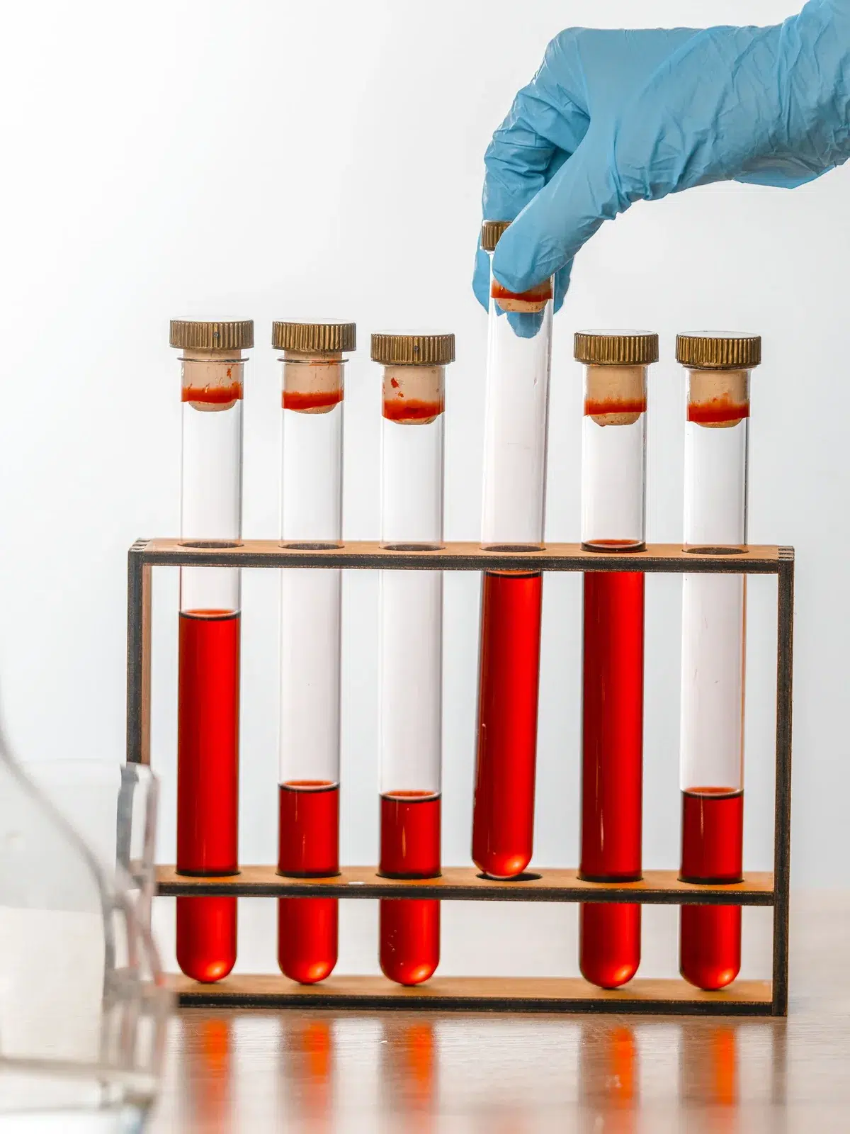 Laboratory quality control inspection of sunscreen test samples